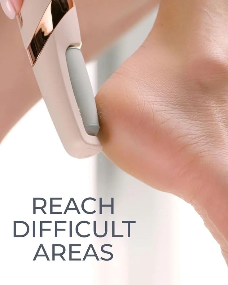 Electric Pedicure Foot File Callus Remover